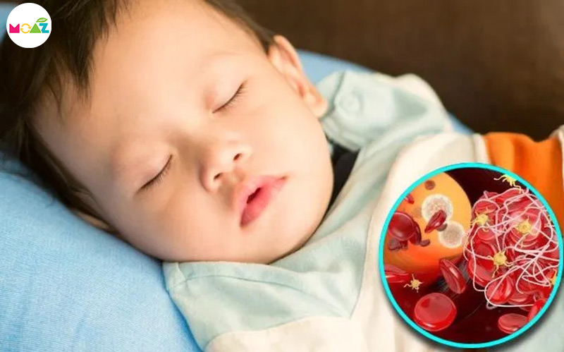 bé ngủ hay giật mình do thiếu sắt